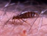 Bedbug bite video